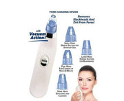Blackhead Suction Remover & Pore Vacuum | Cell Operated