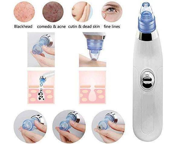 Blackhead Suction Remover & Pore Vacuum | Cell Operated