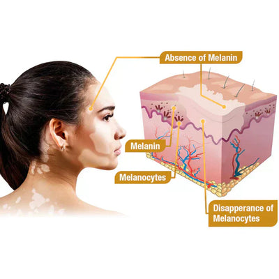 VitiGO™ Revitalizing Bee Venom Cream – Natural Skin Restoration & Vitality 🐝✨